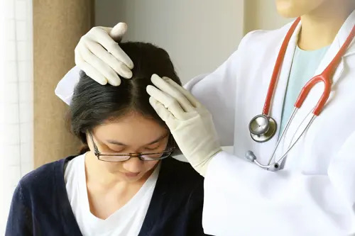 dandruff treatment